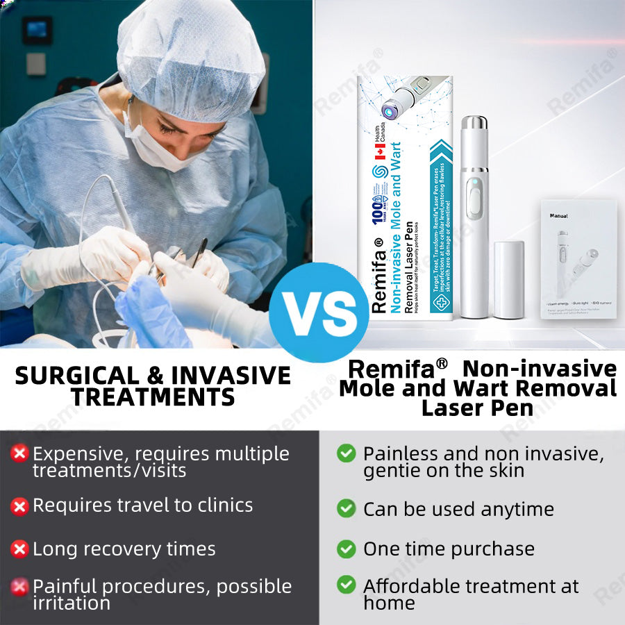 🇨🇦Remifa® Non-invasive Mole & Wart Removal Laser Pen(Quick and painless removal of warts, moles, age spots, and skin tags with no side effects)🔥