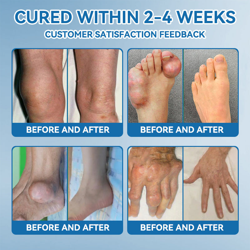 🇨🇦𝐟𝐥𝐲𝐬𝐦𝐮𝐬® 𝐁𝐏𝐂-𝟏𝟓𝟕 𝐉𝐨𝐢𝐧𝐭 𝐇𝐞𝐚𝐥𝐢𝐧𝐠 𝐂𝐫𝐞𝐚𝐦🦴Treats Arthritis, Neuropathy, Rheumatism, Sports Injuries & More🏆