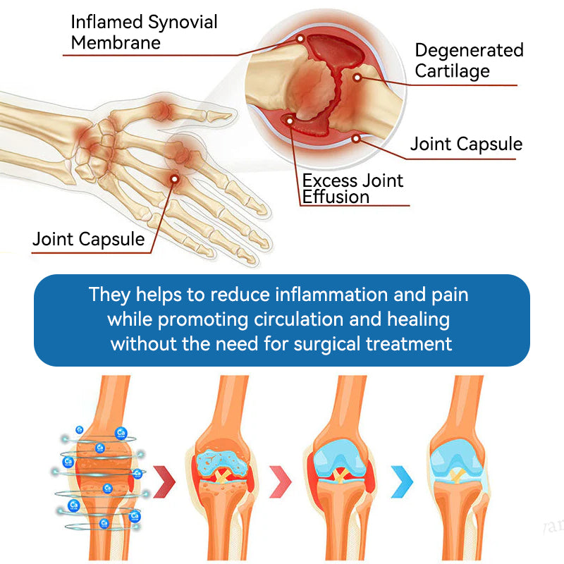 🇨🇦𝐟𝐥𝐲𝐬𝐦𝐮𝐬® 𝐁𝐏𝐂-𝟏𝟓𝟕 𝐉𝐨𝐢𝐧𝐭 𝐇𝐞𝐚𝐥𝐢𝐧𝐠 𝐂𝐫𝐞𝐚𝐦🦴Treats Arthritis, Neuropathy, Rheumatism, Sports Injuries & More🏆