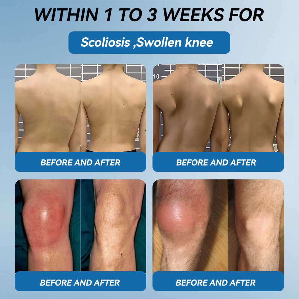 🇨🇦𝐟𝐥𝐲𝐬𝐦𝐮𝐬® 𝐁𝐏𝐂-𝟏𝟓𝟕 𝐉𝐨𝐢𝐧𝐭 𝐇𝐞𝐚𝐥𝐢𝐧𝐠 𝐂𝐫𝐞𝐚𝐦🦴Treats Arthritis, Neuropathy, Rheumatism, Sports Injuries & More🏆