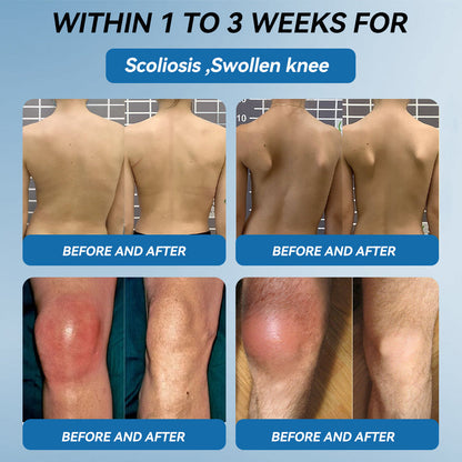 🇨🇦𝐟𝐥𝐲𝐬𝐦𝐮𝐬® 𝐁𝐏𝐂-𝟏𝟓𝟕 𝐉𝐨𝐢𝐧𝐭 𝐇𝐞𝐚𝐥𝐢𝐧𝐠 𝐂𝐫𝐞𝐚𝐦🦴Treats Arthritis, Neuropathy, Rheumatism, Sports Injuries & More🏆