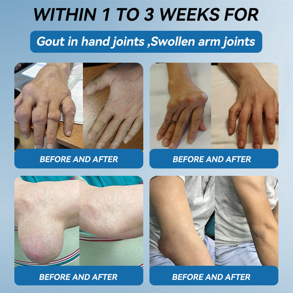 🇨🇦𝐟𝐥𝐲𝐬𝐦𝐮𝐬® 𝐁𝐏𝐂-𝟏𝟓𝟕 𝐉𝐨𝐢𝐧𝐭 𝐇𝐞𝐚𝐥𝐢𝐧𝐠 𝐂𝐫𝐞𝐚𝐦🦴Treats Arthritis, Neuropathy, Rheumatism, Sports Injuries & More🏆