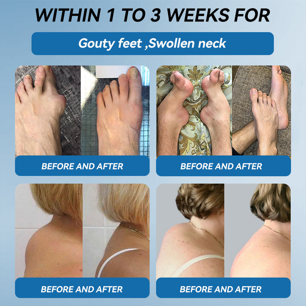 🇨🇦𝐟𝐥𝐲𝐬𝐦𝐮𝐬® 𝐁𝐏𝐂-𝟏𝟓𝟕 𝐉𝐨𝐢𝐧𝐭 𝐇𝐞𝐚𝐥𝐢𝐧𝐠 𝐂𝐫𝐞𝐚𝐦🦴Treats Arthritis, Neuropathy, Rheumatism, Sports Injuries & More🏆
