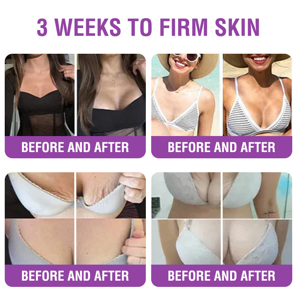 ✳️Made in an FDA-Registered Facility: 𝐅𝐮𝐫𝐳𝐞𝐫𝐨® 𝐐𝐮𝐞𝐞𝐧 𝐍𝐞𝐜𝐭𝐚𝐫 𝐏𝐞𝐩𝐭𝐢𝐝𝐞 + 𝐁𝐚𝐤𝐮𝐜𝐡𝐢𝐨𝐥 𝐒𝐤𝐢𝐧 𝐑𝐞𝐬𝐭𝐨𝐫𝐚𝐭𝐢𝐨𝐧 𝐂𝐫𝐞𝐚𝐦 - 𝐀𝐧𝐭𝐢-𝐚𝐠𝐢𝐧𝐠, 𝐇𝐲𝐝𝐫𝐚𝐭𝐢𝐧𝐠, 𝐒𝐤𝐢𝐧 𝐅𝐢𝐫𝐦𝐢𝐧𝐠 & 𝐋𝐢𝐟𝐭𝐢𝐧𝐠, 𝐒𝐤𝐢𝐧 𝐑𝐞𝐩𝐚𝐢𝐫, 𝐄𝐯𝐞𝐧 𝐓𝐨𝐧𝐞