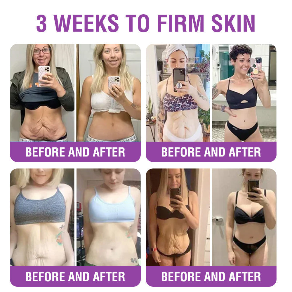 ✳️Made in an FDA-Registered Facility: 𝐅𝐮𝐫𝐳𝐞𝐫𝐨® 𝐐𝐮𝐞𝐞𝐧 𝐍𝐞𝐜𝐭𝐚𝐫 𝐏𝐞𝐩𝐭𝐢𝐝𝐞 + 𝐁𝐚𝐤𝐮𝐜𝐡𝐢𝐨𝐥 𝐒𝐤𝐢𝐧 𝐑𝐞𝐬𝐭𝐨𝐫𝐚𝐭𝐢𝐨𝐧 𝐂𝐫𝐞𝐚𝐦 - 𝐀𝐧𝐭𝐢-𝐚𝐠𝐢𝐧𝐠, 𝐇𝐲𝐝𝐫𝐚𝐭𝐢𝐧𝐠, 𝐒𝐤𝐢𝐧 𝐅𝐢𝐫𝐦𝐢𝐧𝐠 & 𝐋𝐢𝐟𝐭𝐢𝐧𝐠, 𝐒𝐤𝐢𝐧 𝐑𝐞𝐩𝐚𝐢𝐫, 𝐄𝐯𝐞𝐧 𝐓𝐨𝐧𝐞