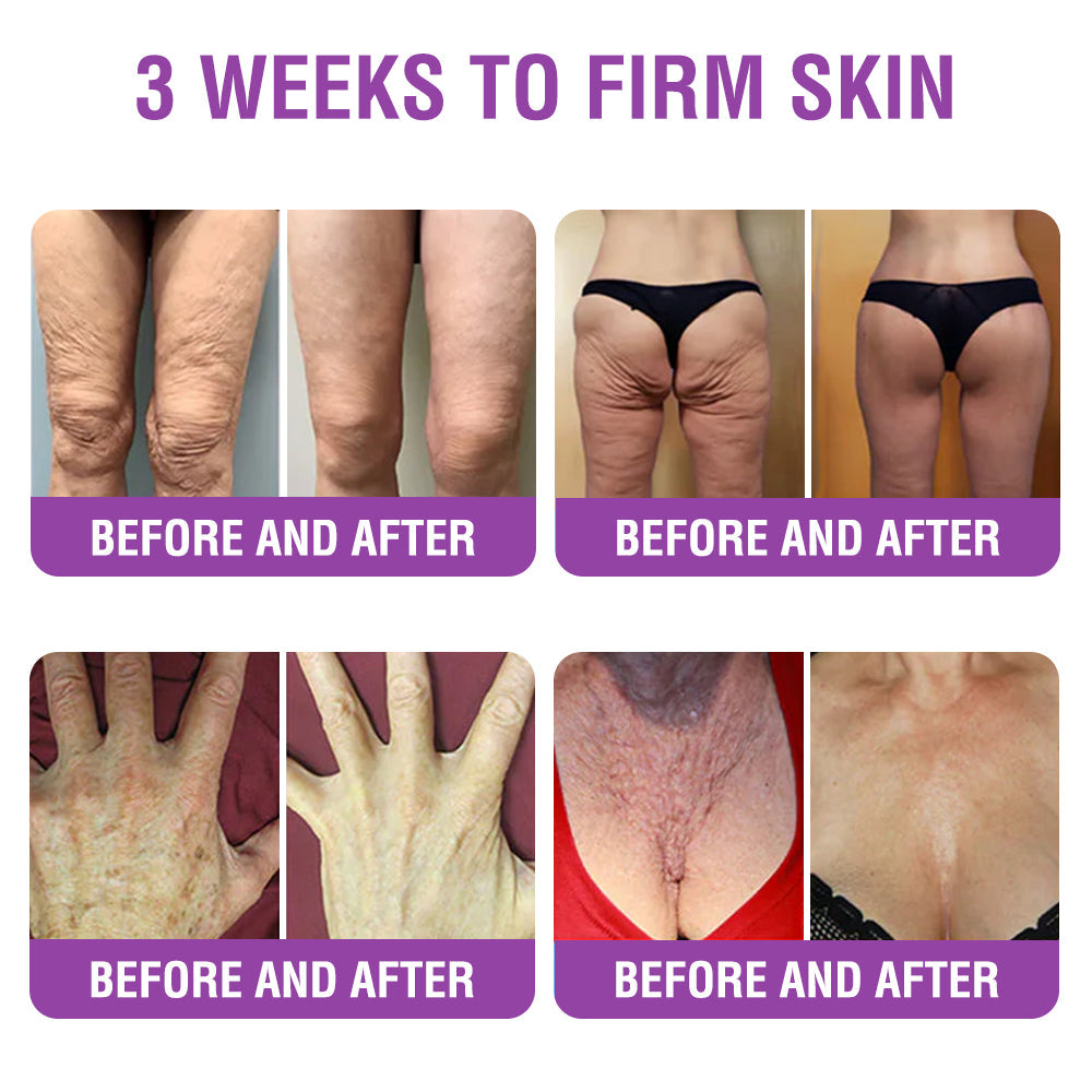 ✳️Made in an FDA-Registered Facility: 𝐅𝐮𝐫𝐳𝐞𝐫𝐨® 𝐐𝐮𝐞𝐞𝐧 𝐍𝐞𝐜𝐭𝐚𝐫 𝐏𝐞𝐩𝐭𝐢𝐝𝐞 + 𝐁𝐚𝐤𝐮𝐜𝐡𝐢𝐨𝐥 𝐒𝐤𝐢𝐧 𝐑𝐞𝐬𝐭𝐨𝐫𝐚𝐭𝐢𝐨𝐧 𝐂𝐫𝐞𝐚𝐦 - 𝐀𝐧𝐭𝐢-𝐚𝐠𝐢𝐧𝐠, 𝐇𝐲𝐝𝐫𝐚𝐭𝐢𝐧𝐠, 𝐒𝐤𝐢𝐧 𝐅𝐢𝐫𝐦𝐢𝐧𝐠 & 𝐋𝐢𝐟𝐭𝐢𝐧𝐠, 𝐒𝐤𝐢𝐧 𝐑𝐞𝐩𝐚𝐢𝐫, 𝐄𝐯𝐞𝐧 𝐓𝐨𝐧𝐞