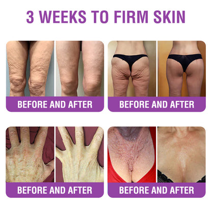 ✳️Made in an FDA-Registered Facility: 𝐅𝐮𝐫𝐳𝐞𝐫𝐨® 𝐐𝐮𝐞𝐞𝐧 𝐍𝐞𝐜𝐭𝐚𝐫 𝐏𝐞𝐩𝐭𝐢𝐝𝐞 + 𝐁𝐚𝐤𝐮𝐜𝐡𝐢𝐨𝐥 𝐒𝐤𝐢𝐧 𝐑𝐞𝐬𝐭𝐨𝐫𝐚𝐭𝐢𝐨𝐧 𝐂𝐫𝐞𝐚𝐦 - 𝐀𝐧𝐭𝐢-𝐚𝐠𝐢𝐧𝐠, 𝐇𝐲𝐝𝐫𝐚𝐭𝐢𝐧𝐠, 𝐒𝐤𝐢𝐧 𝐅𝐢𝐫𝐦𝐢𝐧𝐠 & 𝐋𝐢𝐟𝐭𝐢𝐧𝐠, 𝐒𝐤𝐢𝐧 𝐑𝐞𝐩𝐚𝐢𝐫, 𝐄𝐯𝐞𝐧 𝐓𝐨𝐧𝐞