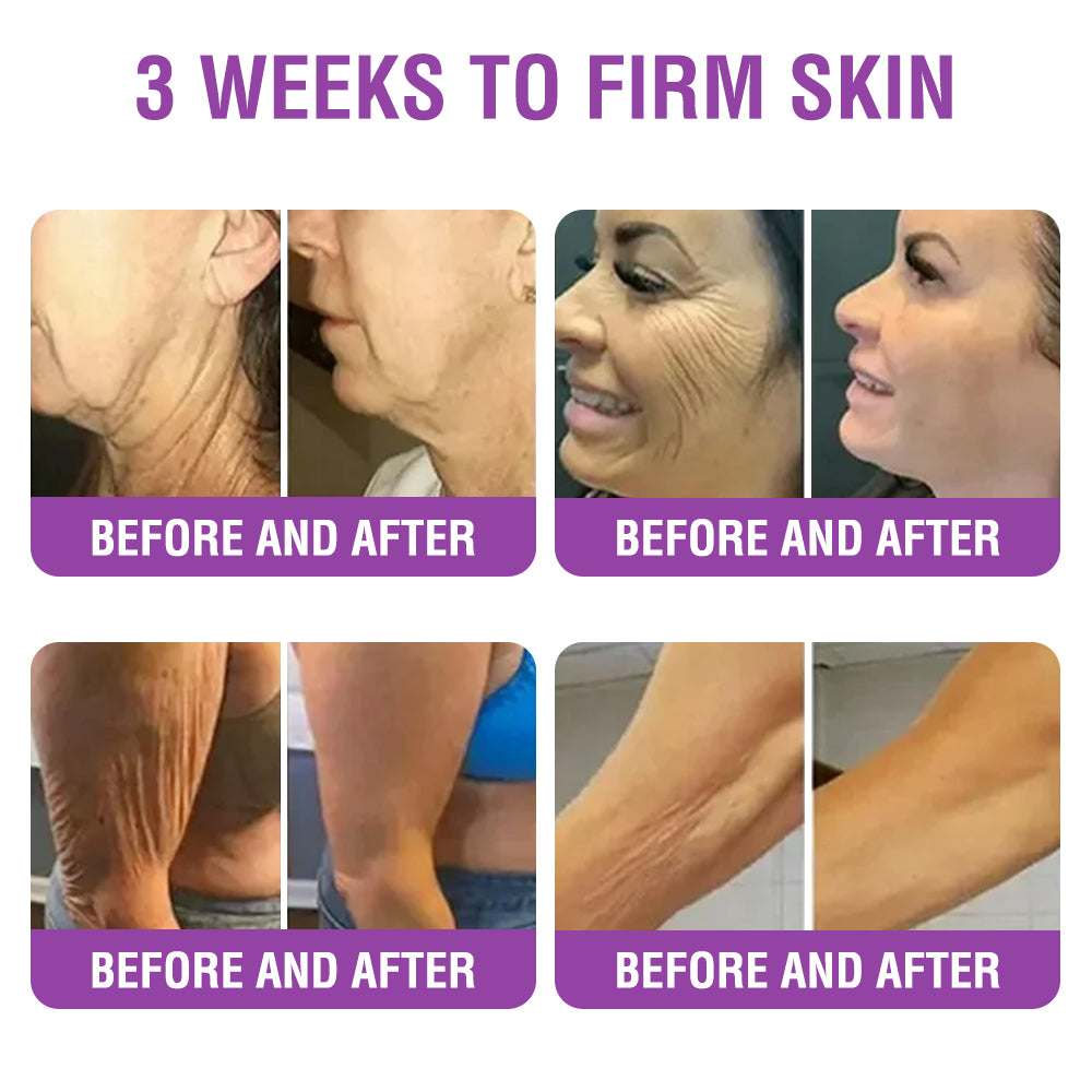 ✳️Made in an FDA-Registered Facility: 𝐅𝐮𝐫𝐳𝐞𝐫𝐨® 𝐐𝐮𝐞𝐞𝐧 𝐍𝐞𝐜𝐭𝐚𝐫 𝐏𝐞𝐩𝐭𝐢𝐝𝐞 + 𝐁𝐚𝐤𝐮𝐜𝐡𝐢𝐨𝐥 𝐒𝐤𝐢𝐧 𝐑𝐞𝐬𝐭𝐨𝐫𝐚𝐭𝐢𝐨𝐧 𝐂𝐫𝐞𝐚𝐦 - 𝐀𝐧𝐭𝐢-𝐚𝐠𝐢𝐧𝐠, 𝐇𝐲𝐝𝐫𝐚𝐭𝐢𝐧𝐠, 𝐒𝐤𝐢𝐧 𝐅𝐢𝐫𝐦𝐢𝐧𝐠 & 𝐋𝐢𝐟𝐭𝐢𝐧𝐠, 𝐒𝐤𝐢𝐧 𝐑𝐞𝐩𝐚𝐢𝐫, 𝐄𝐯𝐞𝐧 𝐓𝐨𝐧𝐞