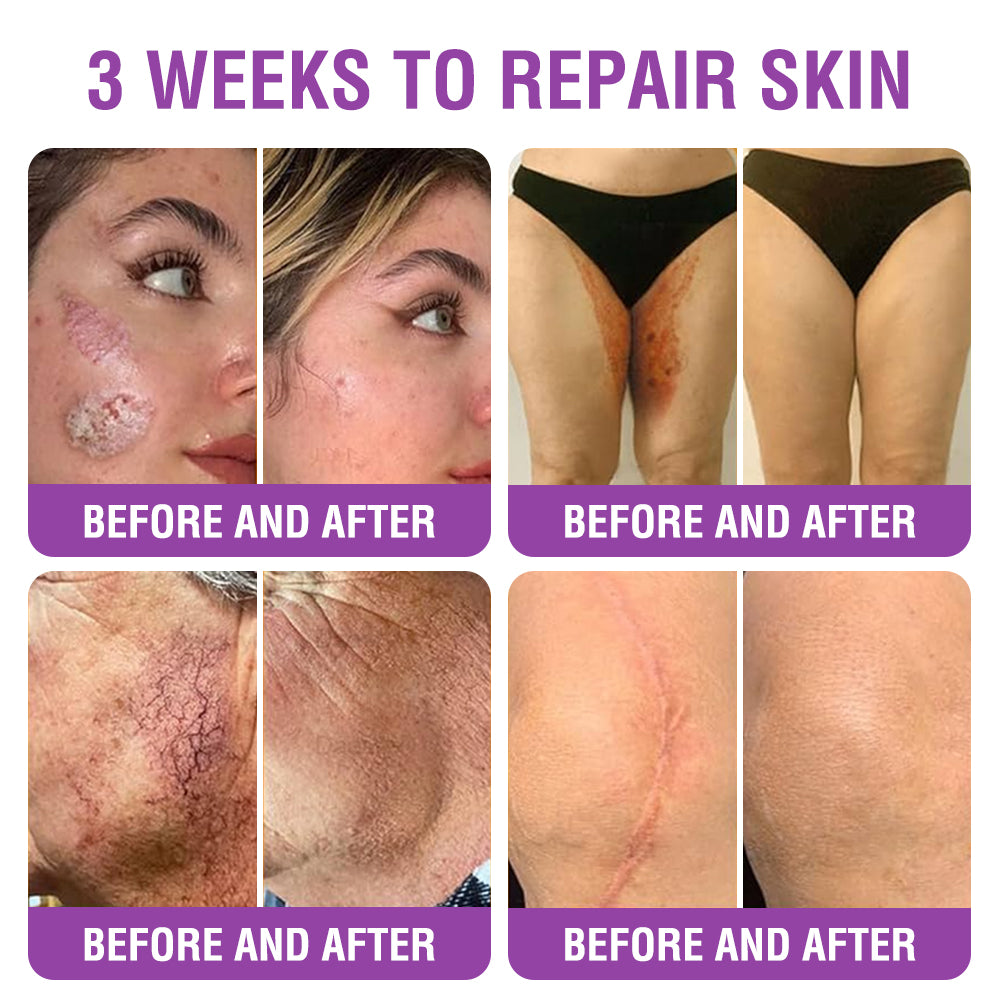 ✳️Made in an FDA-Registered Facility: 𝐅𝐮𝐫𝐳𝐞𝐫𝐨® 𝐐𝐮𝐞𝐞𝐧 𝐍𝐞𝐜𝐭𝐚𝐫 𝐏𝐞𝐩𝐭𝐢𝐝𝐞 + 𝐁𝐚𝐤𝐮𝐜𝐡𝐢𝐨𝐥 𝐒𝐤𝐢𝐧 𝐑𝐞𝐬𝐭𝐨𝐫𝐚𝐭𝐢𝐨𝐧 𝐂𝐫𝐞𝐚𝐦 - 𝐀𝐧𝐭𝐢-𝐚𝐠𝐢𝐧𝐠, 𝐇𝐲𝐝𝐫𝐚𝐭𝐢𝐧𝐠, 𝐒𝐤𝐢𝐧 𝐅𝐢𝐫𝐦𝐢𝐧𝐠 & 𝐋𝐢𝐟𝐭𝐢𝐧𝐠, 𝐒𝐤𝐢𝐧 𝐑𝐞𝐩𝐚𝐢𝐫, 𝐄𝐯𝐞𝐧 𝐓𝐨𝐧𝐞