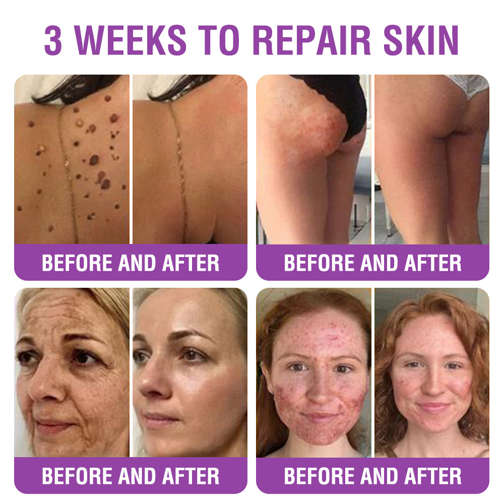 ✳️Made in an FDA-Registered Facility: 𝐅𝐮𝐫𝐳𝐞𝐫𝐨® 𝐐𝐮𝐞𝐞𝐧 𝐍𝐞𝐜𝐭𝐚𝐫 𝐏𝐞𝐩𝐭𝐢𝐝𝐞 + 𝐁𝐚𝐤𝐮𝐜𝐡𝐢𝐨𝐥 𝐒𝐤𝐢𝐧 𝐑𝐞𝐬𝐭𝐨𝐫𝐚𝐭𝐢𝐨𝐧 𝐂𝐫𝐞𝐚𝐦 - 𝐀𝐧𝐭𝐢-𝐚𝐠𝐢𝐧𝐠, 𝐇𝐲𝐝𝐫𝐚𝐭𝐢𝐧𝐠, 𝐒𝐤𝐢𝐧 𝐅𝐢𝐫𝐦𝐢𝐧𝐠 & 𝐋𝐢𝐟𝐭𝐢𝐧𝐠, 𝐒𝐤𝐢𝐧 𝐑𝐞𝐩𝐚𝐢𝐫, 𝐄𝐯𝐞𝐧 𝐓𝐨𝐧𝐞