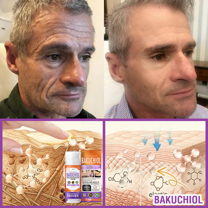 ✳️Made in an FDA-Registered Facility: 𝐅𝐮𝐫𝐳𝐞𝐫𝐨® 𝐐𝐮𝐞𝐞𝐧 𝐍𝐞𝐜𝐭𝐚𝐫 𝐏𝐞𝐩𝐭𝐢𝐝𝐞 + 𝐁𝐚𝐤𝐮𝐜𝐡𝐢𝐨𝐥 𝐒𝐤𝐢𝐧 𝐑𝐞𝐬𝐭𝐨𝐫𝐚𝐭𝐢𝐨𝐧 𝐂𝐫𝐞𝐚𝐦 - 𝐀𝐧𝐭𝐢-𝐚𝐠𝐢𝐧𝐠, 𝐇𝐲𝐝𝐫𝐚𝐭𝐢𝐧𝐠, 𝐒𝐤𝐢𝐧 𝐅𝐢𝐫𝐦𝐢𝐧𝐠 & 𝐋𝐢𝐟𝐭𝐢𝐧𝐠, 𝐒𝐤𝐢𝐧 𝐑𝐞𝐩𝐚𝐢𝐫, 𝐄𝐯𝐞𝐧 𝐓𝐨𝐧𝐞