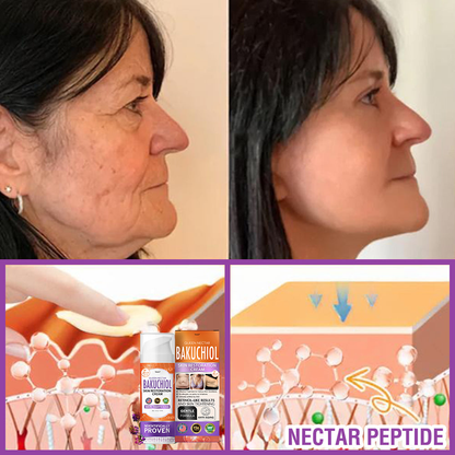 ✳️Made in an FDA-Registered Facility: 𝐅𝐮𝐫𝐳𝐞𝐫𝐨® 𝐐𝐮𝐞𝐞𝐧 𝐍𝐞𝐜𝐭𝐚𝐫 𝐏𝐞𝐩𝐭𝐢𝐝𝐞 + 𝐁𝐚𝐤𝐮𝐜𝐡𝐢𝐨𝐥 𝐒𝐤𝐢𝐧 𝐑𝐞𝐬𝐭𝐨𝐫𝐚𝐭𝐢𝐨𝐧 𝐂𝐫𝐞𝐚𝐦 - 𝐀𝐧𝐭𝐢-𝐚𝐠𝐢𝐧𝐠, 𝐇𝐲𝐝𝐫𝐚𝐭𝐢𝐧𝐠, 𝐒𝐤𝐢𝐧 𝐅𝐢𝐫𝐦𝐢𝐧𝐠 & 𝐋𝐢𝐟𝐭𝐢𝐧𝐠, 𝐒𝐤𝐢𝐧 𝐑𝐞𝐩𝐚𝐢𝐫, 𝐄𝐯𝐞𝐧 𝐓𝐨𝐧𝐞