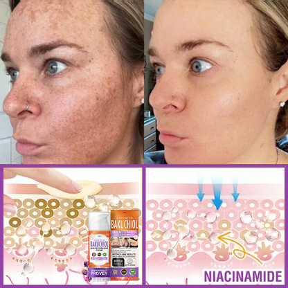 ✳️Made in an FDA-Registered Facility: 𝐅𝐮𝐫𝐳𝐞𝐫𝐨® 𝐐𝐮𝐞𝐞𝐧 𝐍𝐞𝐜𝐭𝐚𝐫 𝐏𝐞𝐩𝐭𝐢𝐝𝐞 + 𝐁𝐚𝐤𝐮𝐜𝐡𝐢𝐨𝐥 𝐒𝐤𝐢𝐧 𝐑𝐞𝐬𝐭𝐨𝐫𝐚𝐭𝐢𝐨𝐧 𝐂𝐫𝐞𝐚𝐦 - 𝐀𝐧𝐭𝐢-𝐚𝐠𝐢𝐧𝐠, 𝐇𝐲𝐝𝐫𝐚𝐭𝐢𝐧𝐠, 𝐒𝐤𝐢𝐧 𝐅𝐢𝐫𝐦𝐢𝐧𝐠 & 𝐋𝐢𝐟𝐭𝐢𝐧𝐠, 𝐒𝐤𝐢𝐧 𝐑𝐞𝐩𝐚𝐢𝐫, 𝐄𝐯𝐞𝐧 𝐓𝐨𝐧𝐞